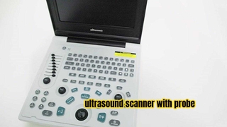 Safelife medische apparatuur Ultrasone scanner